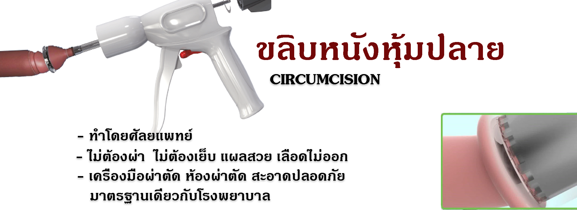 06 - ETERNITY CLINIC นพ.สืบพงษ์ เอ่งฉ้วน เเกนองคชาต ขลิบหนังหุ้มปลาย ประเภทของแกนองคชาตเทียม