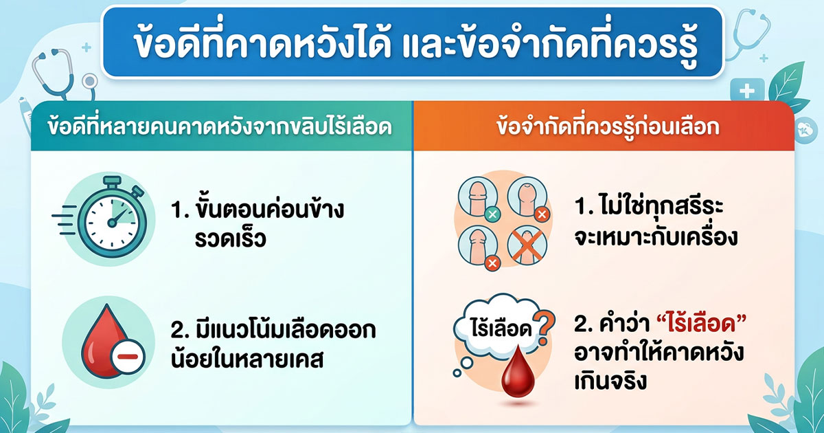 ข้อดีที่คาดหวังได้และข้อจำกัดที่ควรรู้ก่อนเลือกขลิบไร้เลือด
