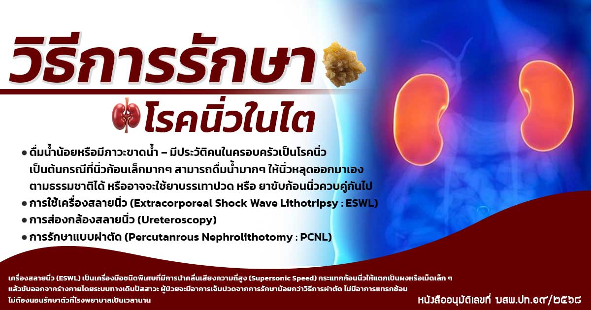 3.qwwe - ETERNITY CLINIC นพ.สืบพงษ์ เอ่งฉ้วน วิธีการรักษาโรคนิ่วในไต มีอะไรบ้าง ESWL