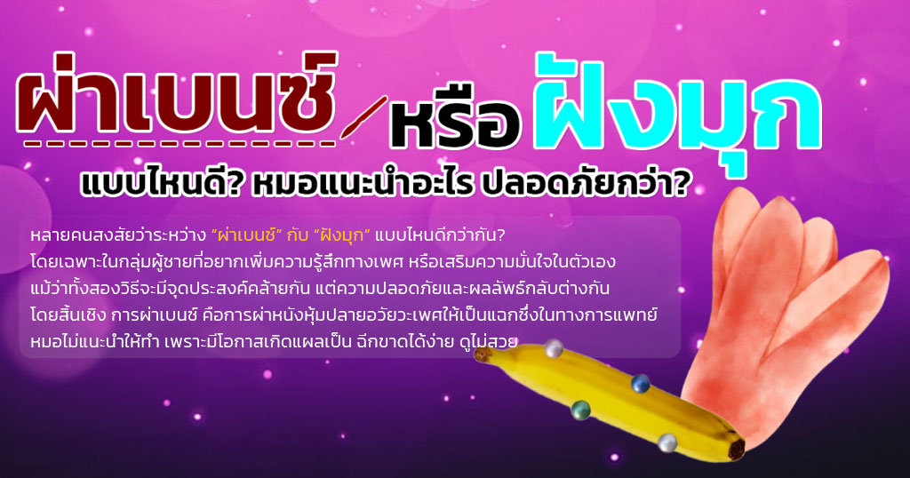 rf - ETERNITY CLINIC นพ.สืบพงษ์ เอ่งฉ้วน ผ่าเบนซ์