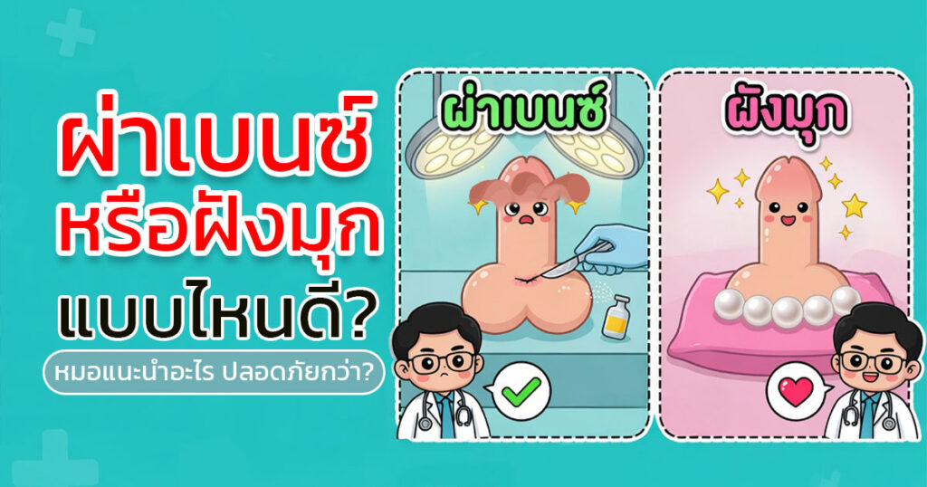 ty cs - ETERNITY CLINIC นพ.สืบพงษ์ เอ่งฉ้วน ผ่าเบนซ์หรือฝังมุก