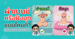 ผ่าเบนซ์หรือฝังมุก