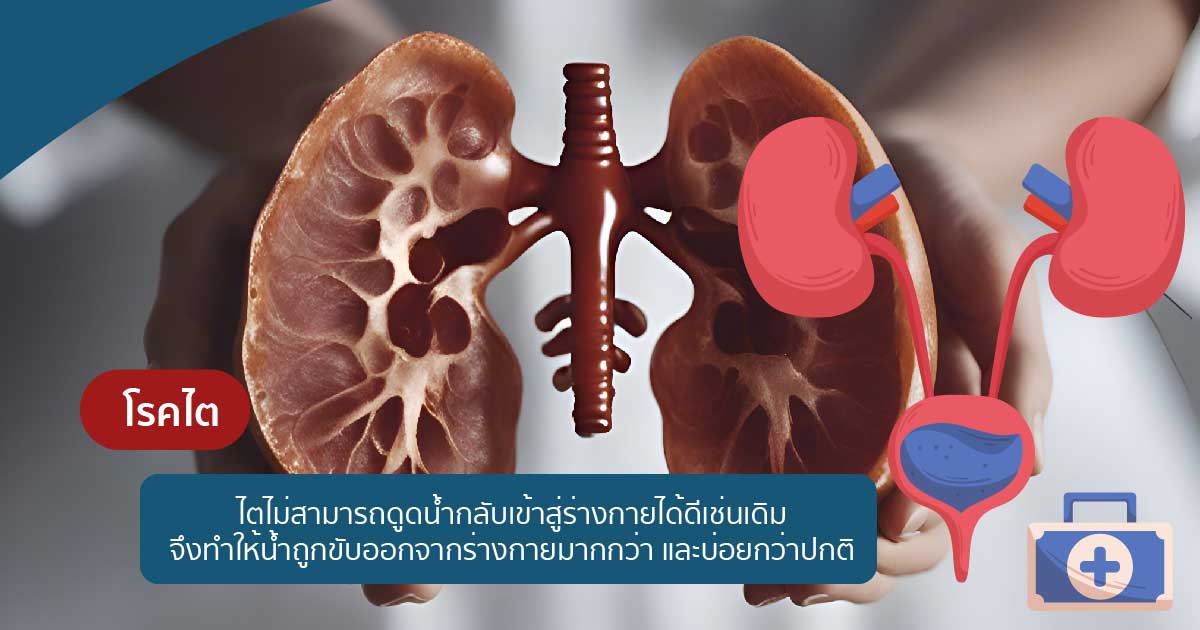 dfds - ETERNITY CLINIC นพ.สืบพงษ์ เอ่งฉ้วน ปัสสาวะขุ่น