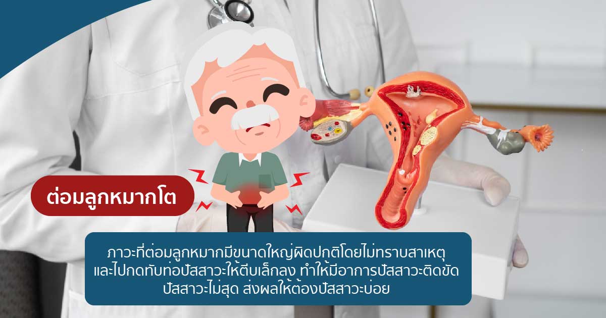 dfssdf - ETERNITY CLINIC นพ.สืบพงษ์ เอ่งฉ้วน เจ็บเสียวปลายท่อปัสสาวะ