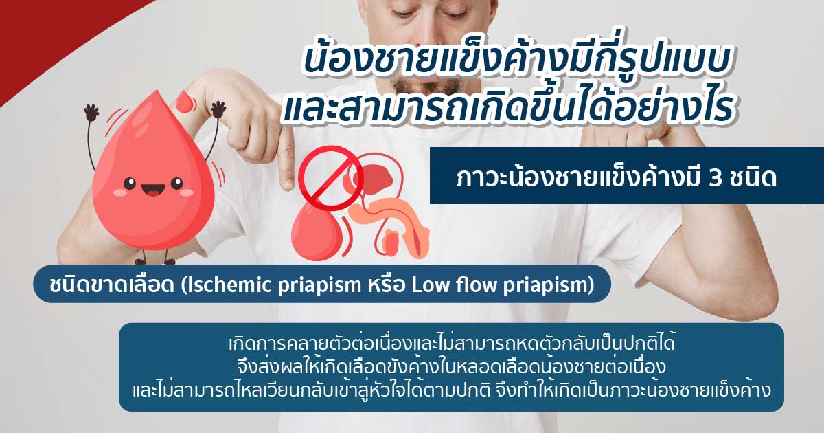 องคชาตแข็งตัวค้าง