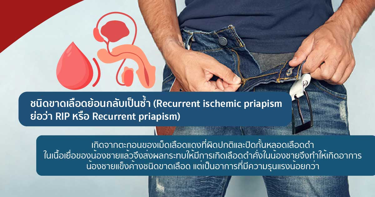 RIP - ETERNITY CLINIC นพ.สืบพงษ์ เอ่งฉ้วน องคชาตแข็งตัวนานผิดปกติ