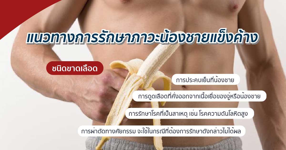 dccv - ETERNITY CLINIC นพ.สืบพงษ์ เอ่งฉ้วน ภาวะหย่อนสมรรถภาพทางเพศ