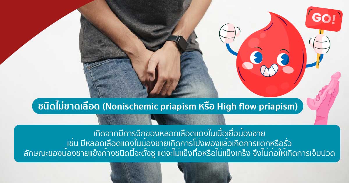 dj - ETERNITY CLINIC นพ.สืบพงษ์ เอ่งฉ้วน ภาวะน้องชายแข็งค้าง