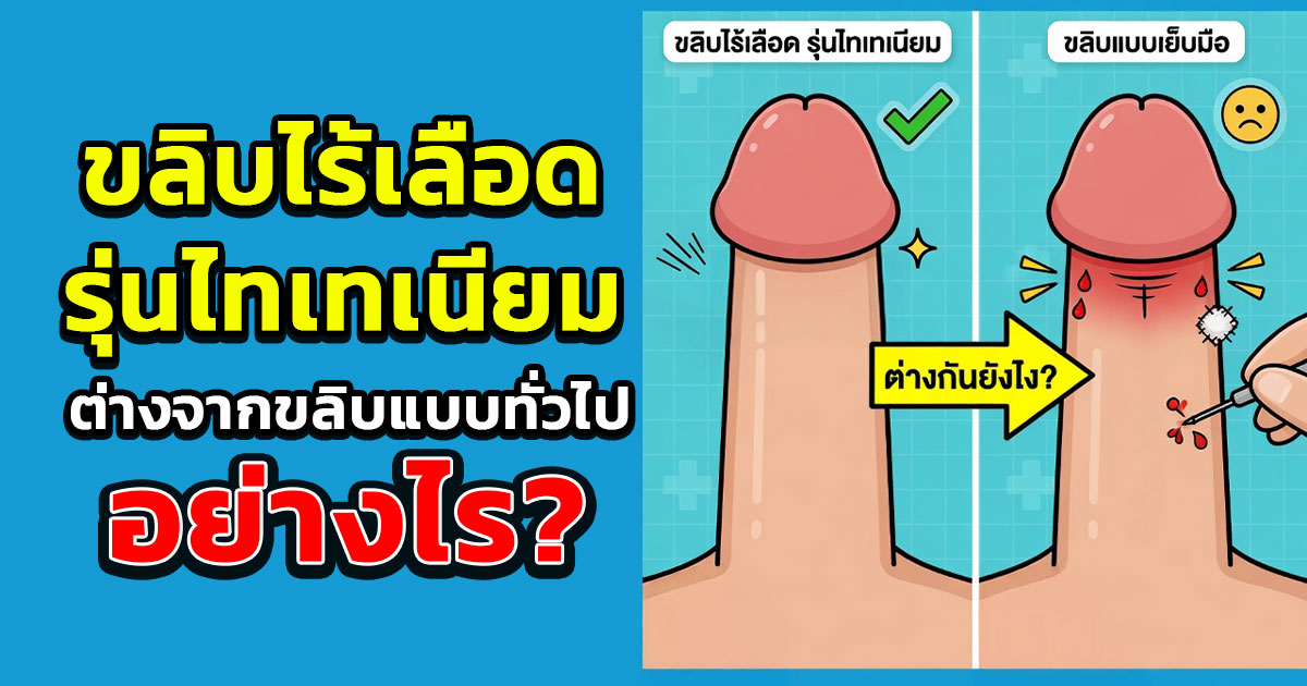 ขลิบฟื้นตัวไว