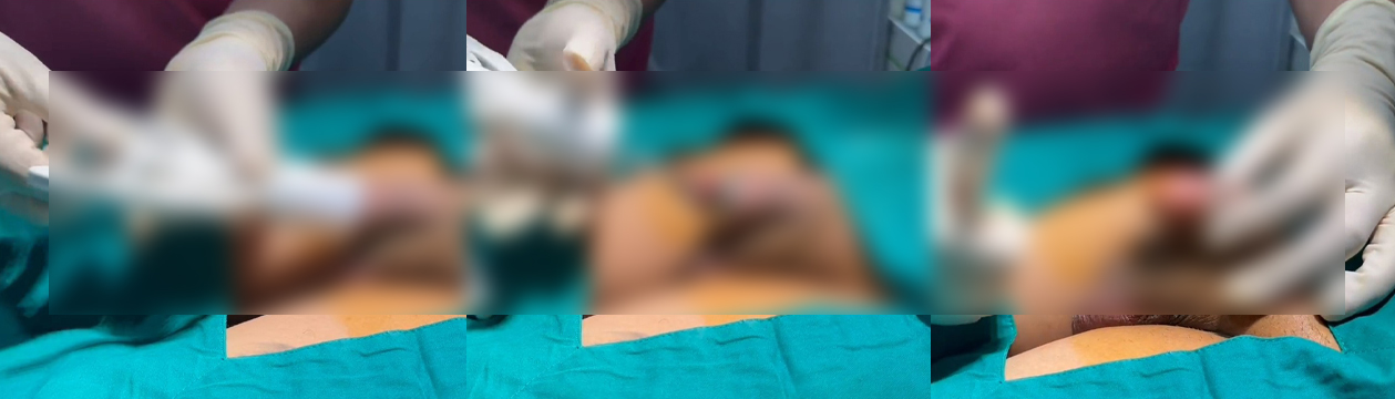 circumcision0 - ETERNITY CLINIC นพ.สืบพงษ์ เอ่งฉ้วน