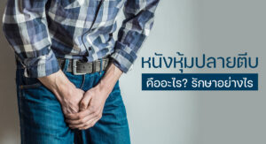 หนังหุ้มปลายตีบ
