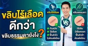 ขลิบไร้เลือดดีกว่าขลิธรรมดายังไง