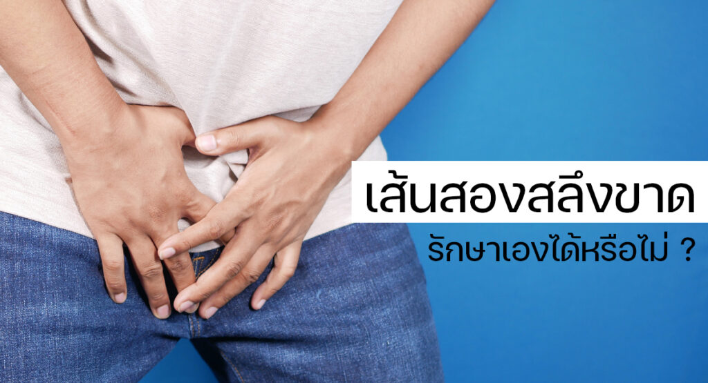 Frenulum - ETERNITY CLINIC นพ.สืบพงษ์ เอ่งฉ้วน เส้นสองสลึงขาด