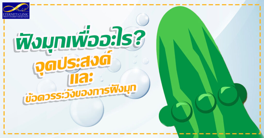 1. What is the purpose of pearl implantation - Purpose and precautions for pearl implantation - ETERNITY CLINIC นพ.สืบพงษ์ เอ่งฉ้วน ฝังมุกกระจู๋