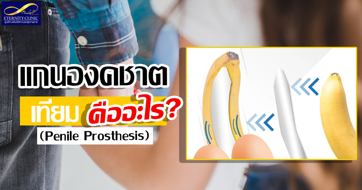 2. What is a penile prosthesis - ETERNITY CLINIC นพ.สืบพงษ์ เอ่งฉ้วน แกนองคชาตเทียม