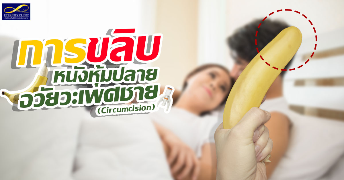 การขลิบหนังหุ้มปลายอวัยวะเพศชาย (Circumcision)