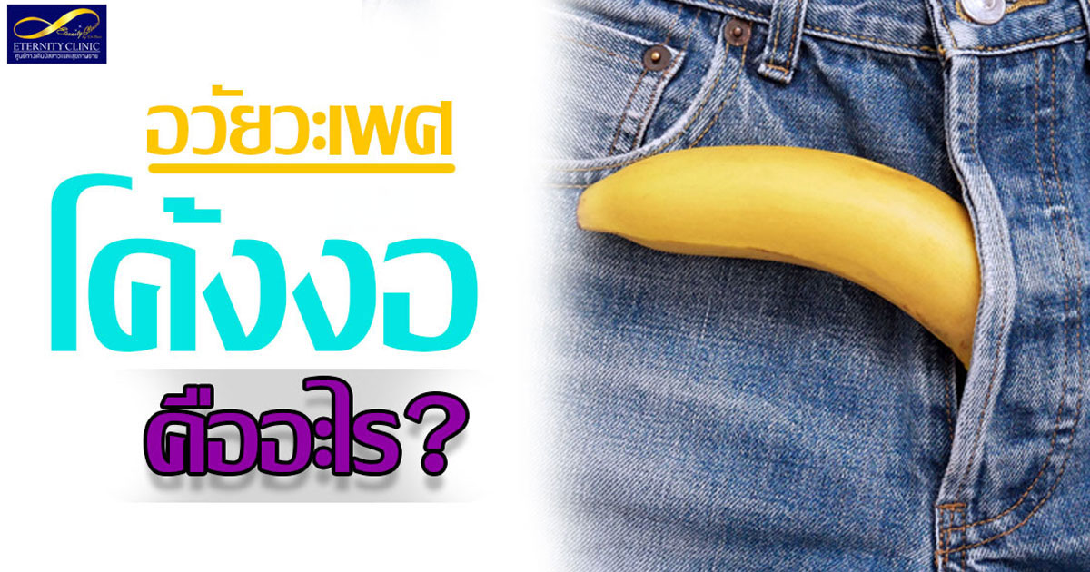 อวัยวะเพศโค้งงอ