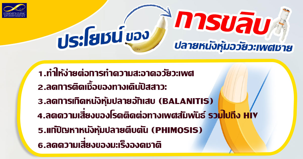 3.Benefits of male circumcision - ETERNITY CLINIC นพ.สืบพงษ์ เอ่งฉ้วน ประโยชน์ของการขลิบหนังหุ้มปลายอวัยวะเพศชาย มีอะไรบ้าง ง่ายต่อการทำความสะอาด ลดการติดเชื้อได้