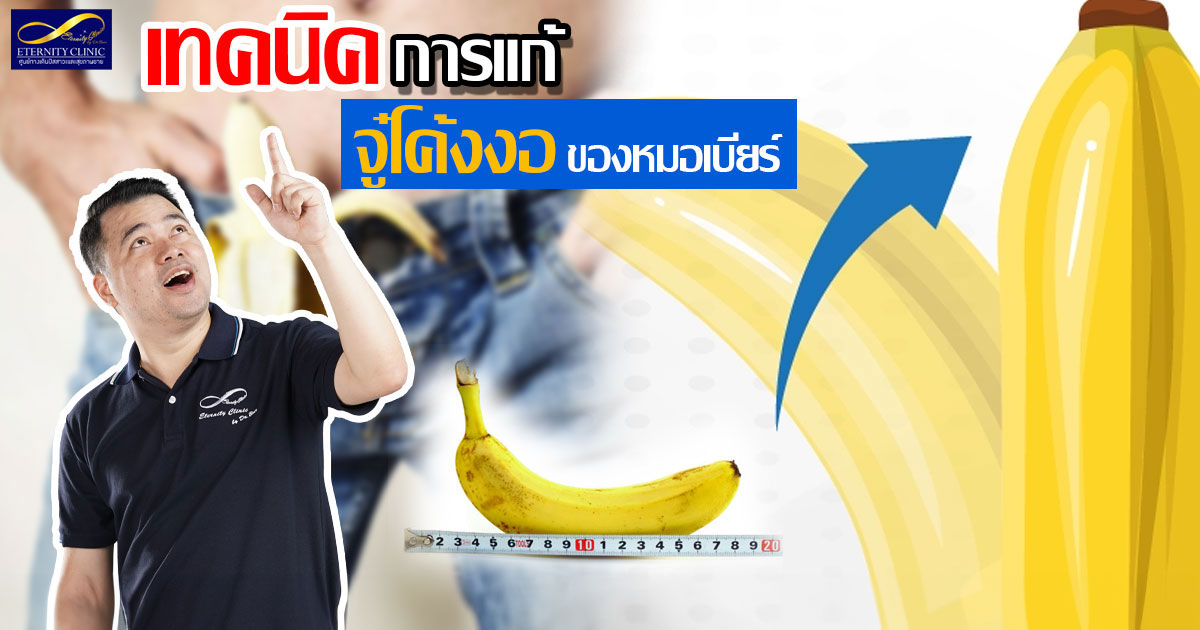 5.Dr. Beer's technique for fixing a curved penis - ETERNITY CLINIC นพ.สืบพงษ์ เอ่งฉ้วน อวัยวะเพศโค้งงอ