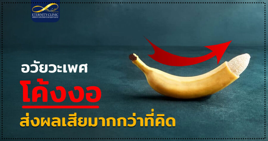 1. Curved penis causes more damage than you think. - ETERNITY CLINIC นพ.สืบพงษ์ เอ่งฉ้วน อวัยวะเพศโค้งงอ