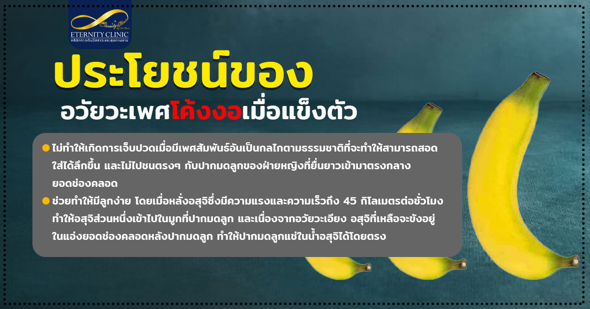 3. Benefits of a curved penis when erect - ETERNITY CLINIC นพ.สืบพงษ์ เอ่งฉ้วน อวัยวะเพศโค้งงอ ประโยชน์ของอวัยวะเพศโค้งงอเมื่อแข็ง หมอเบียร์ Eternity Clinic