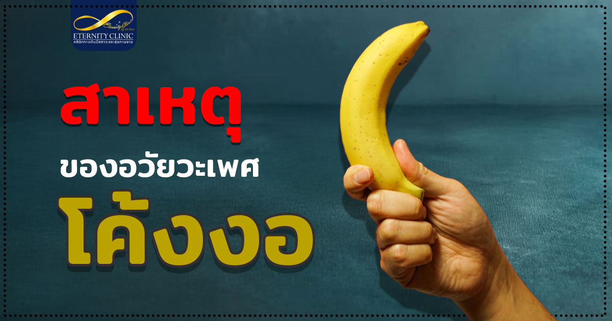 4. Causes of a curved penis - ETERNITY CLINIC นพ.สืบพงษ์ เอ่งฉ้วน อวัยวะเพศโค้งงอ สาเหตุของอวัยวะเพศโค้งงอ หมอเบียร์ Eternity Clinic