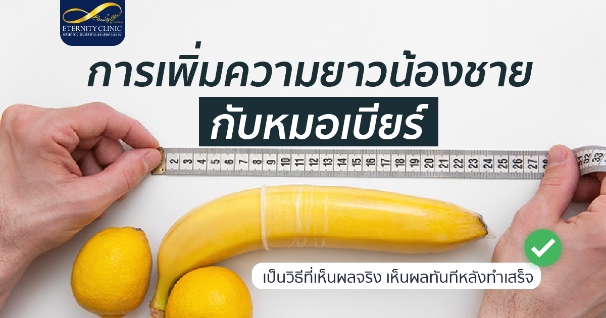 เพิ่มความยาวน้องชาย อยากเพิ่มความยาวน้องชายกับหมอเบียร์