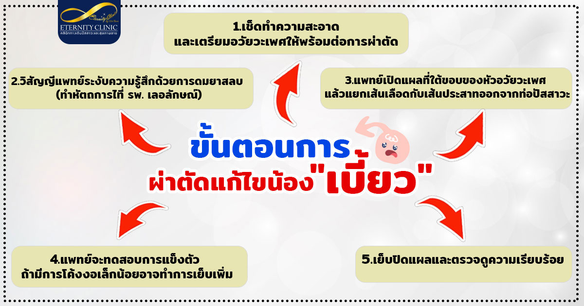 4.Surgery-steps-to-correct-a-crooked-penis - ETERNITY CLINIC นพ.สืบพงษ์ เอ่งฉ้วน ขั้นตอนการผ่าตัดแก้ไข น้องชายเบี้ยว