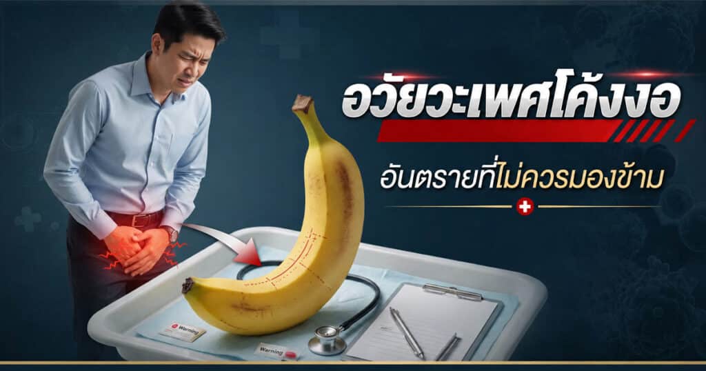 อวัยวะเพศโค้งงอ