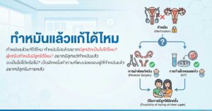 ทำหมันชาย