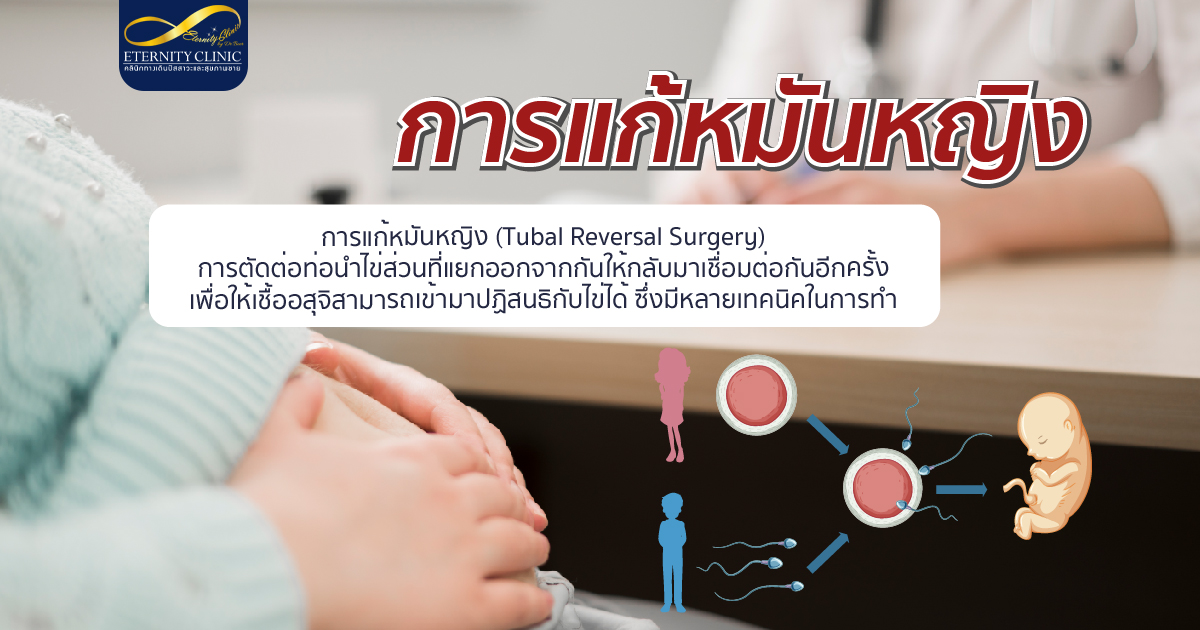 bod12.3 - ETERNITY CLINIC นพ.สืบพงษ์ เอ่งฉ้วน การแก้หมันหญิง
