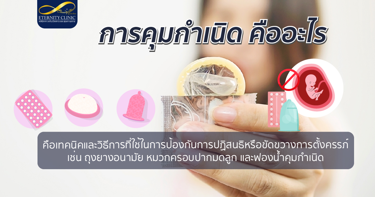 bod13.2 - ETERNITY CLINIC นพ.สืบพงษ์ เอ่งฉ้วน การคุมกำเนิด คืออะไร