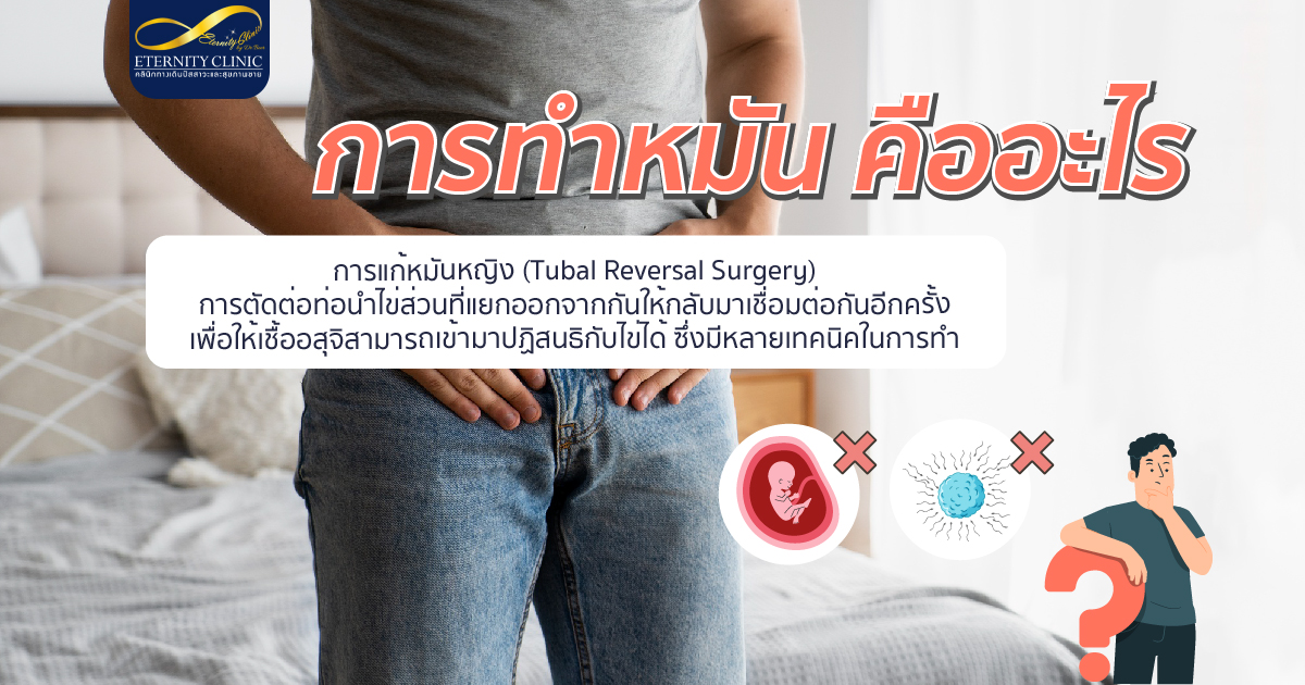 bod13.3 - ETERNITY CLINIC นพ.สืบพงษ์ เอ่งฉ้วน การทำหมัน คืออะไร