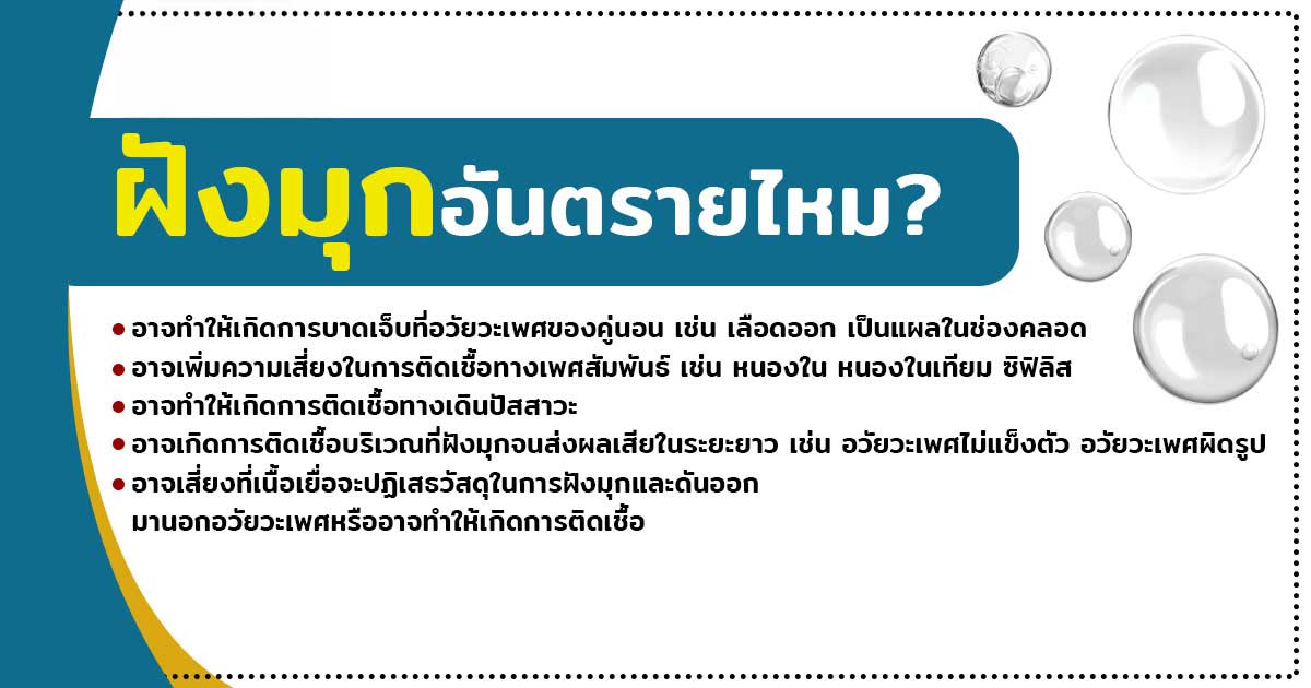 cc - ETERNITY CLINIC นพ.สืบพงษ์ เอ่งฉ้วน ฝังมุกอันตรายไหม