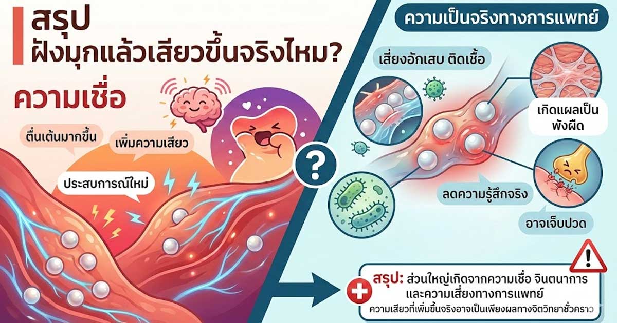 cccl - ETERNITY CLINIC นพ.สืบพงษ์ เอ่งฉ้วน ฝังมุกแล้วเสียวขึ้นจริงไหม