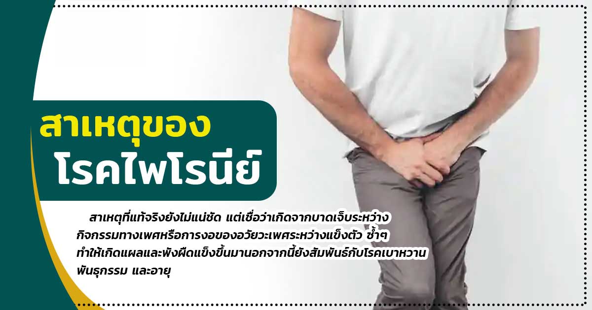 ccl - ETERNITY CLINIC นพ.สืบพงษ์ เอ่งฉ้วน สาเหตุของโรคไพโรนีย์