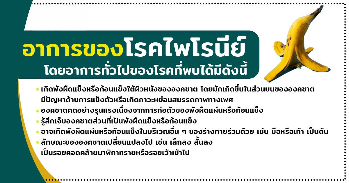 ccvb - ETERNITY CLINIC นพ.สืบพงษ์ เอ่งฉ้วน อาการของโรคไพโรนีย์