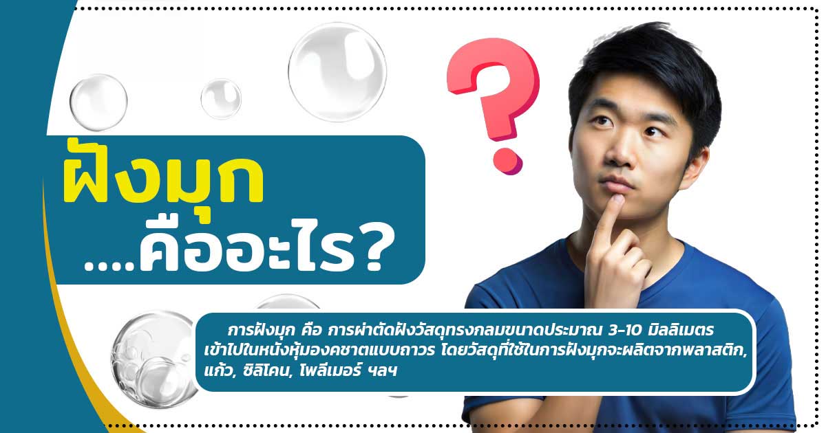 ฝังมุกคืออะไร