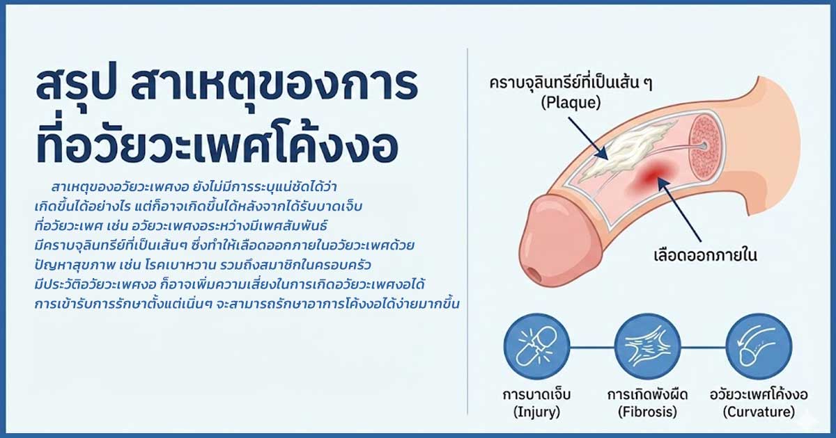 dccxxxx - ETERNITY CLINIC นพ.สืบพงษ์ เอ่งฉ้วน อวัยวะเพศโค้งงอ