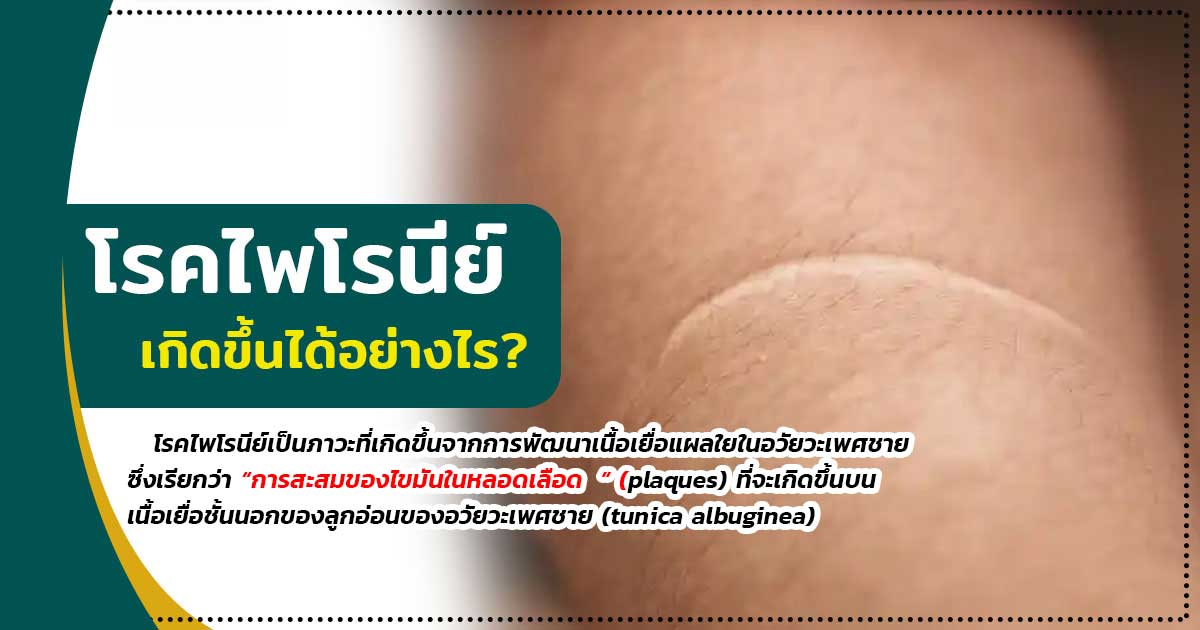 ffg - ETERNITY CLINIC นพ.สืบพงษ์ เอ่งฉ้วน โรคไพโรนีย์เกิดขึ้นได้อย่างไร