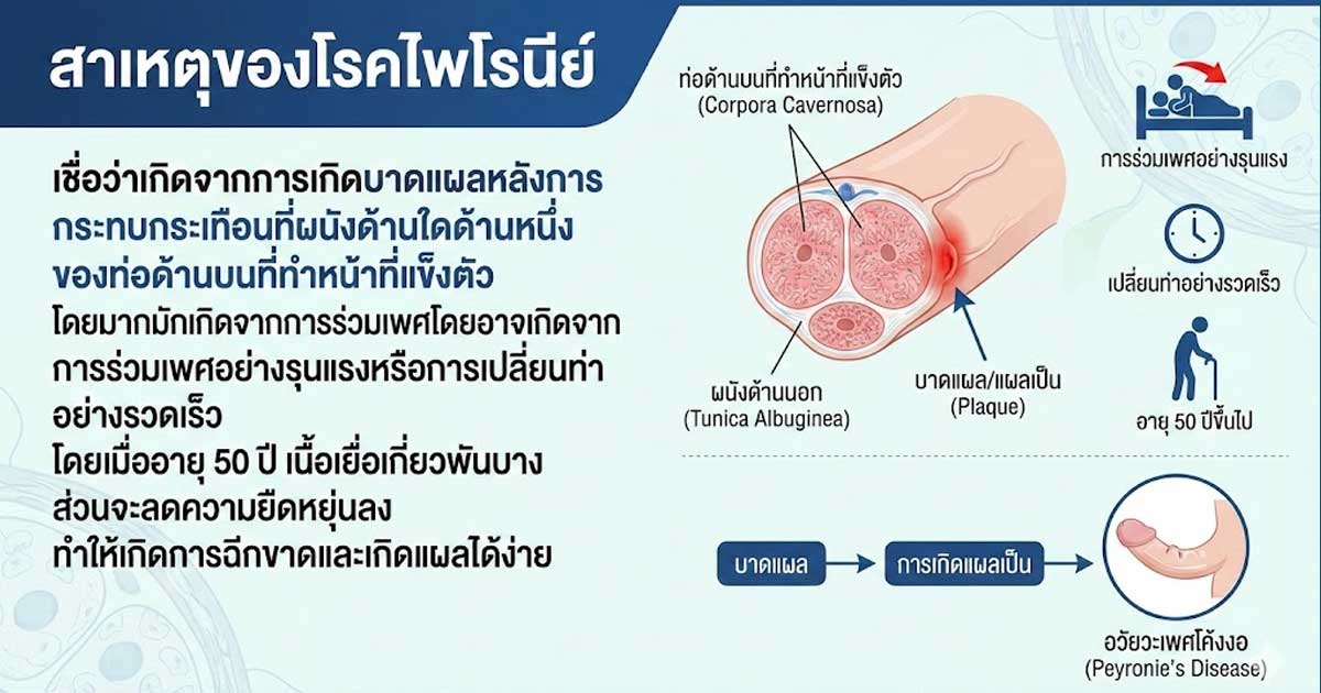 fh - ETERNITY CLINIC นพ.สืบพงษ์ เอ่งฉ้วน อวัยวะเพศโค้งงอ