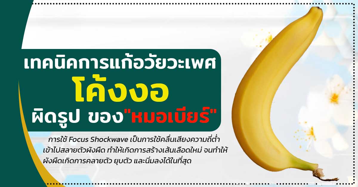 jh - ETERNITY CLINIC นพ.สืบพงษ์ เอ่งฉ้วน แก้น้องชายโค้งงอ