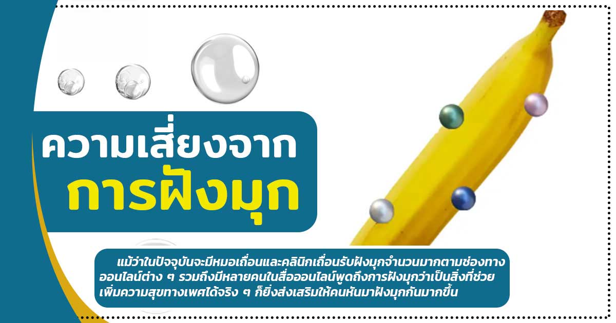 oik - ETERNITY CLINIC นพ.สืบพงษ์ เอ่งฉ้วน ความเสี่ยงฝังมุก