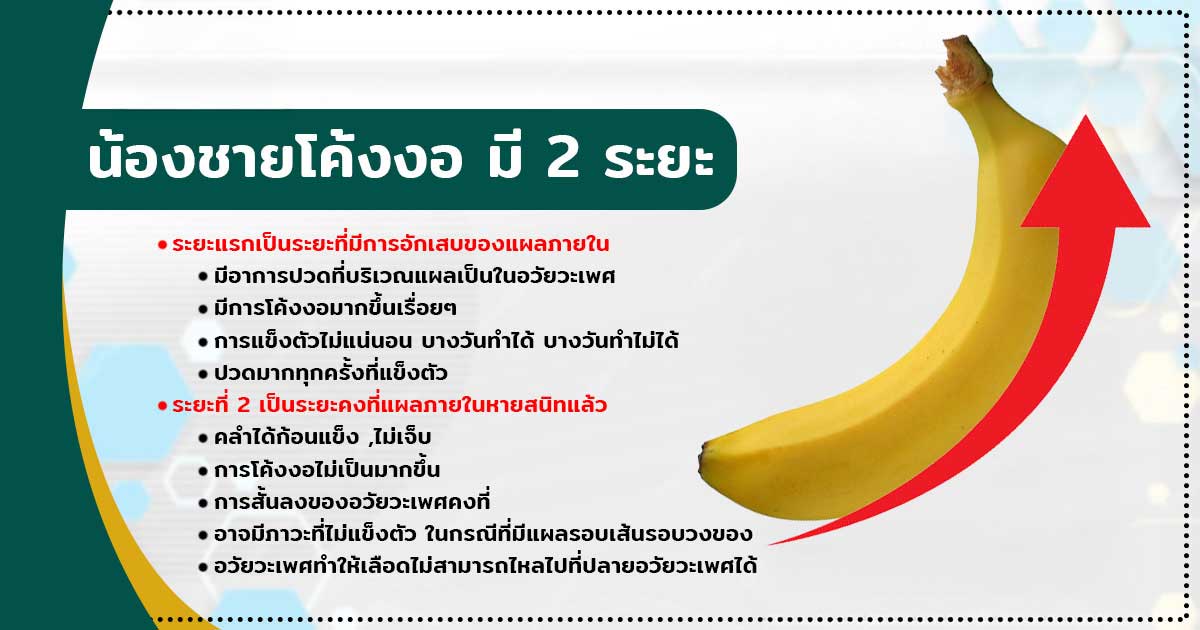 rt - ETERNITY CLINIC นพ.สืบพงษ์ เอ่งฉ้วน น้องชายโค้งงอ