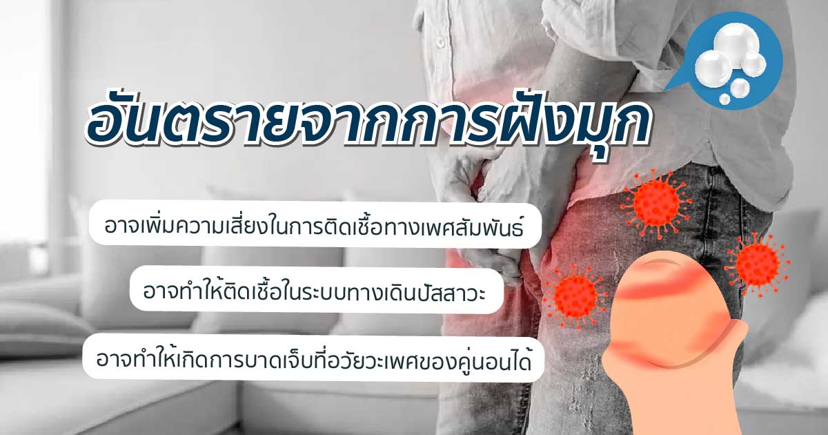 bod-37 - ETERNITY CLINIC นพ.สืบพงษ์ เอ่งฉ้วน ตกเเต่งอวัยวะเพศ