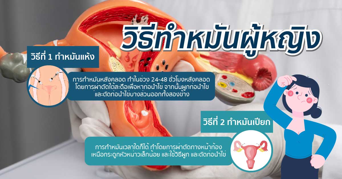 bod - ETERNITY CLINIC นพ.สืบพงษ์ เอ่งฉ้วน วิธีทำหมันผู้หญิง