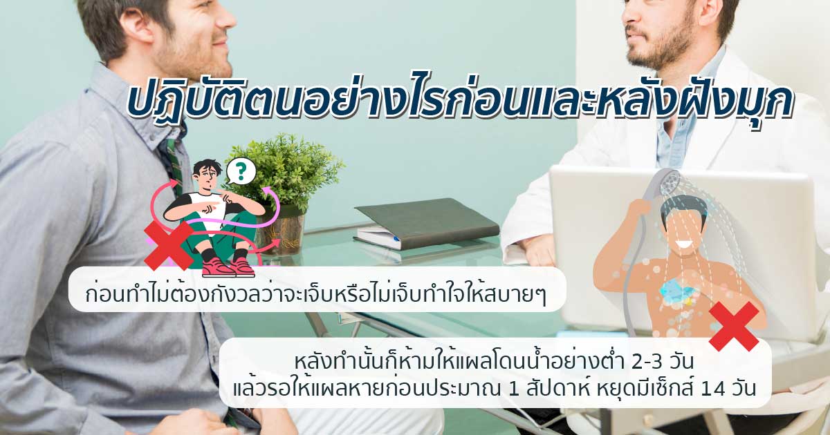 dc2 - ETERNITY CLINIC นพ.สืบพงษ์ เอ่งฉ้วน ฝังมุกอันตรายไหม