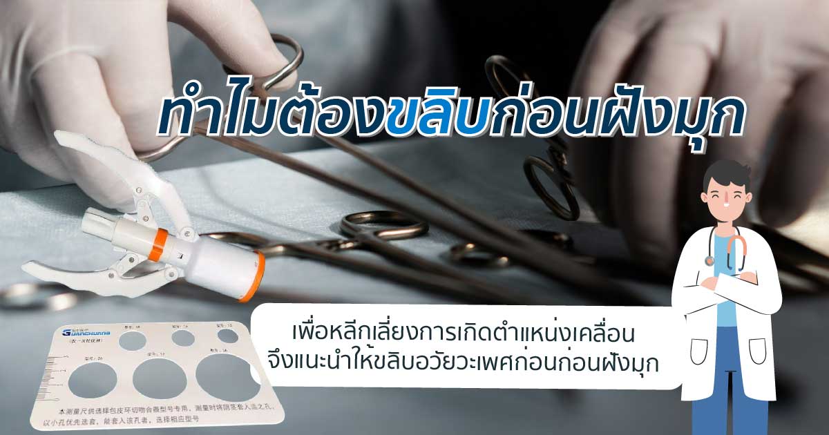 dccbb - ETERNITY CLINIC นพ.สืบพงษ์ เอ่งฉ้วน ฝังมุก ราคา