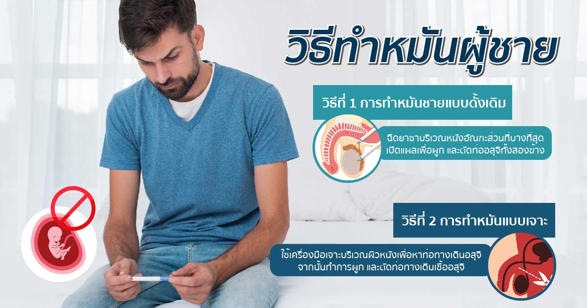 ทำหมันชาย