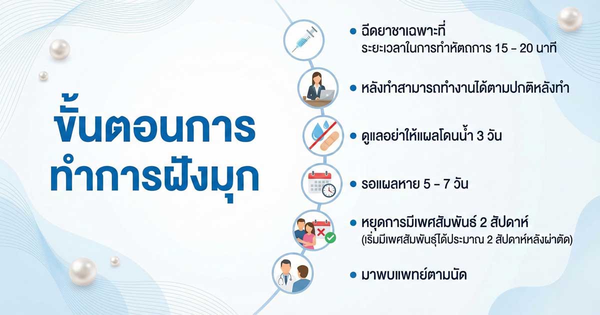 dfcp - ETERNITY CLINIC นพ.สืบพงษ์ เอ่งฉ้วน ขั้นตอนการทำการฝังมุก